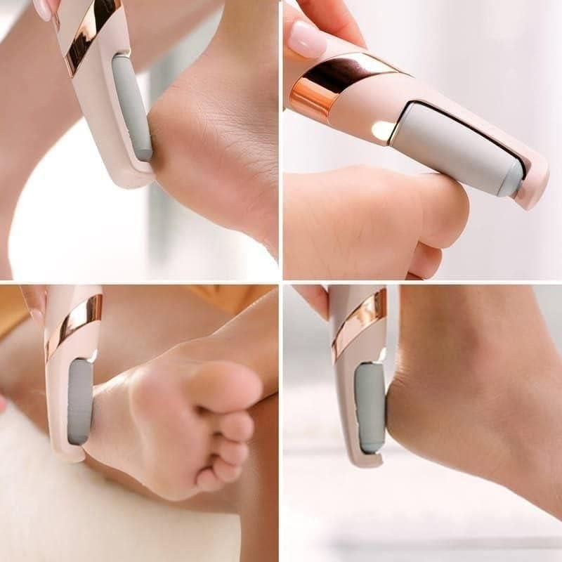 Electronic Pedicure Callus Remover